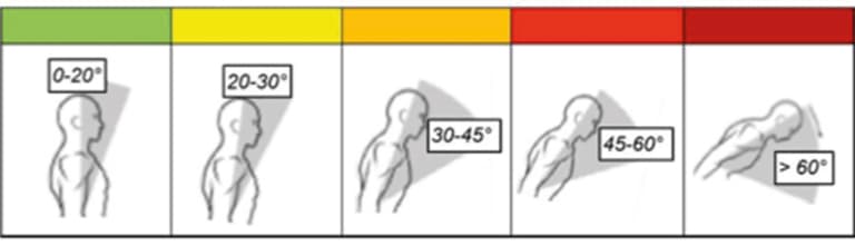 Image-775x400-Désherbage-ergo.jpg